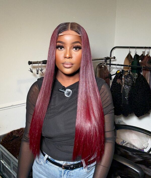 DONOR BONESTRAIGHT - Image 4