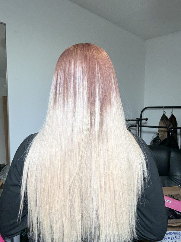 DONOR BONESTRAIGHT - Image 4